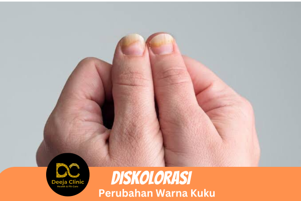 Kuku kering dan mudah patah